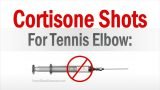 Cortisone Shots For Treating Tennis Elbow