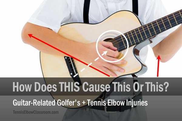How guitar playing causes injuries