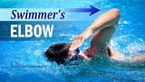 Thumbnail for video on swimming, Tennis Elbow and Swimmer's Elbow