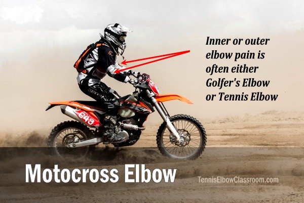 Motocross Elbow
