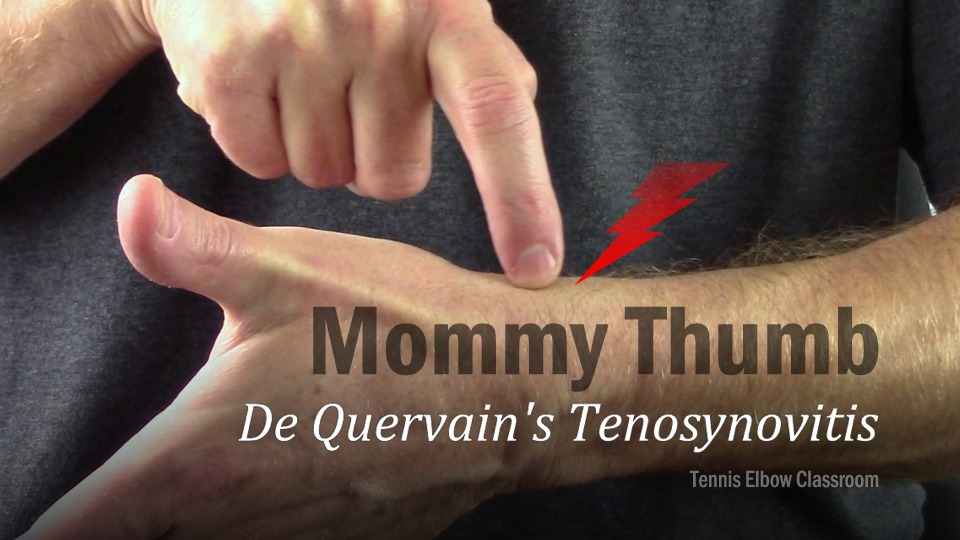 Photo of thumb - Pain in this spot is often De Quervains Tenosynovitis