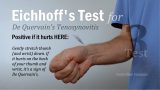 Image showing how to self-perform Eichhoff's Test on thumb for De Quervain's